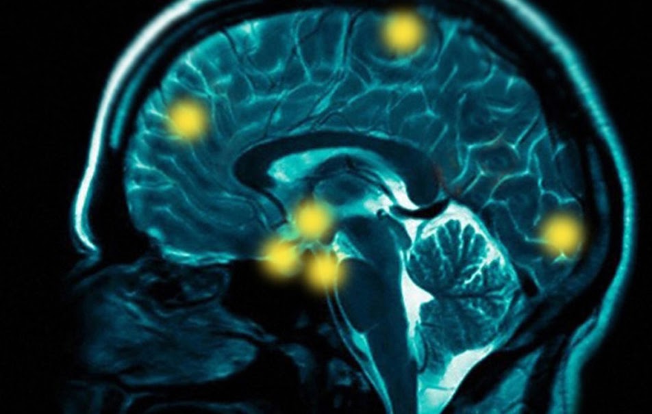 xray scan of the human head