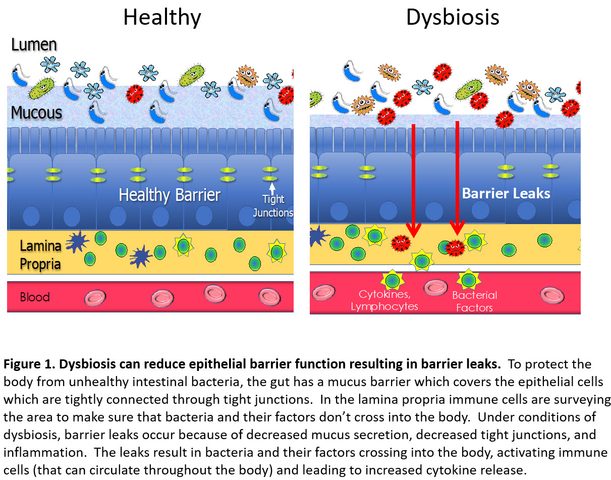 Dysbiosis Illustration